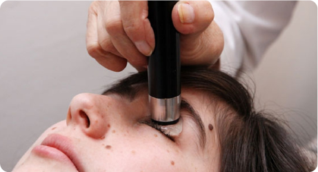 Ultrassonografia Ocular